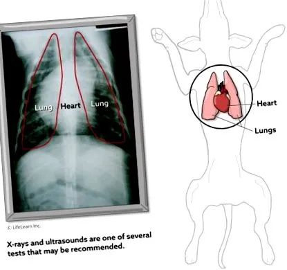 pulmonară