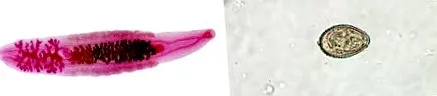 clonorchis