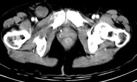 abdominal