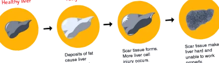 liver