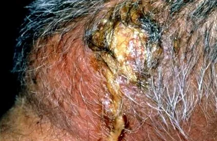 dermatologice