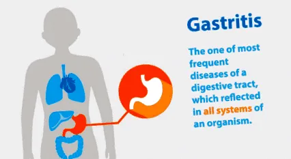 gastrita