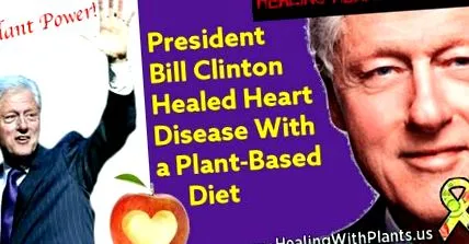 bill