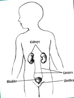 sindromul