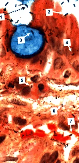 helicobacter