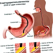 intestinului