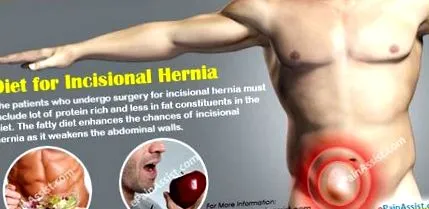 herniahome
