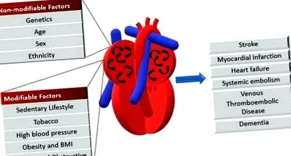 miocardic