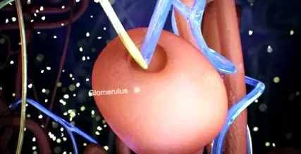 диабет insipidus