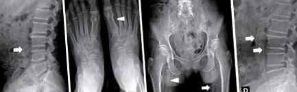 suplimentare