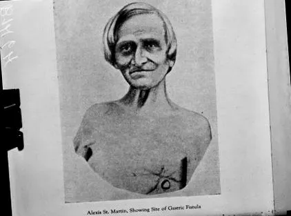számára
