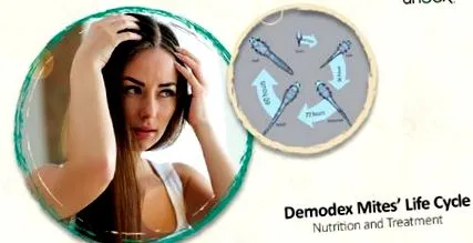 Demodex atkák