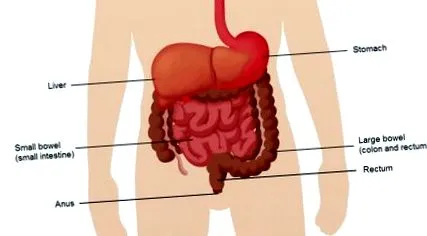 crohn