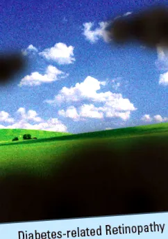 предотвратете