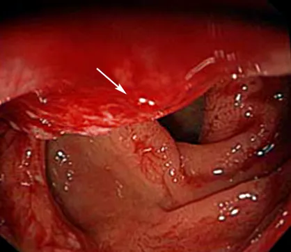 recto-sigmoid