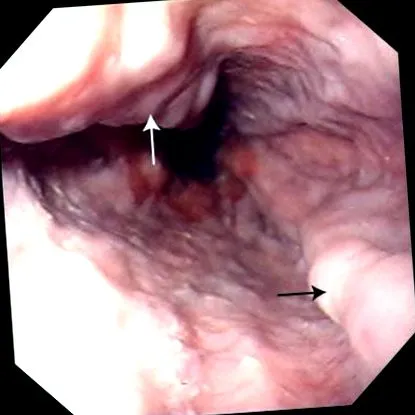 digestive