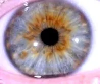 diagnosticarea