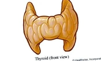 hipotiroidism