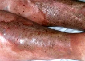 dermnet