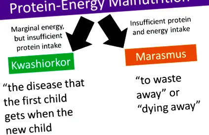 nutrition