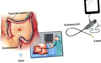 дебелото