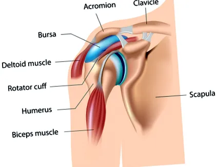 bursita