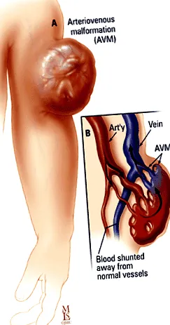 radiologie