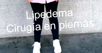 липедема