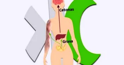 кетонни