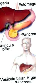 stent