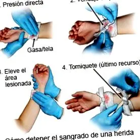 lipoma care
