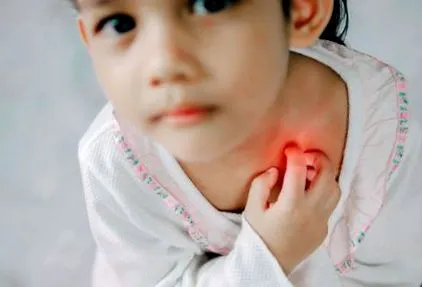 erythema