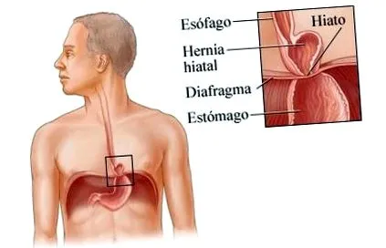 хиаталната