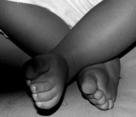 миозит