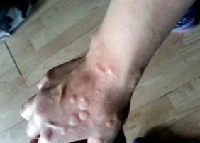 гістаміну гістаміну