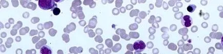 нейни