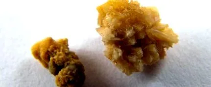 камъни