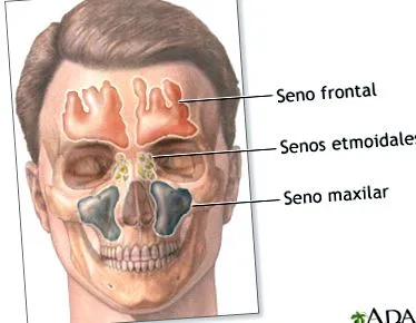 medlineplus