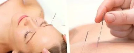 tölgykert