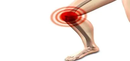 arthritis