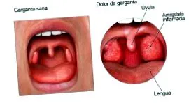 antibiotikumhasználat