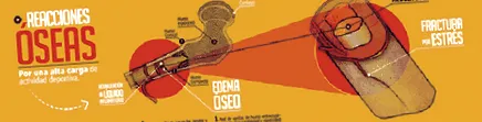 оток