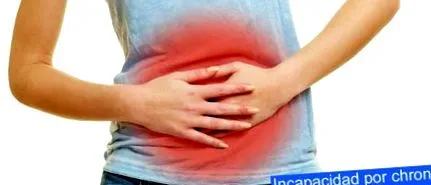 болестта Crohn