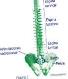 spondylitis ankylopoetica