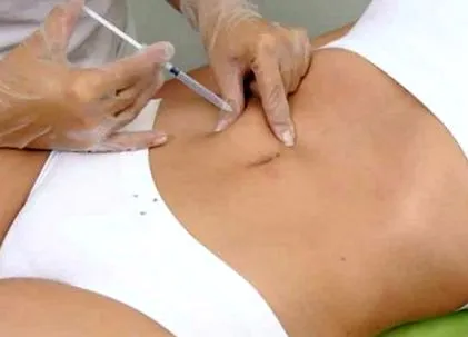mesoterápiai