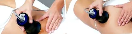 kavitáció