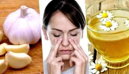 sinusitis