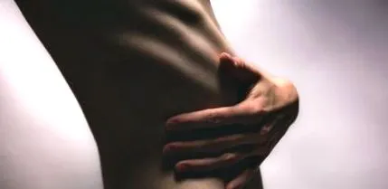 vigorexia