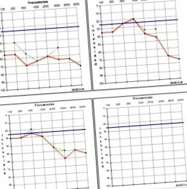 раптова втрати слуху