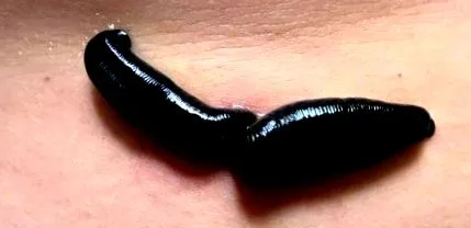típusai